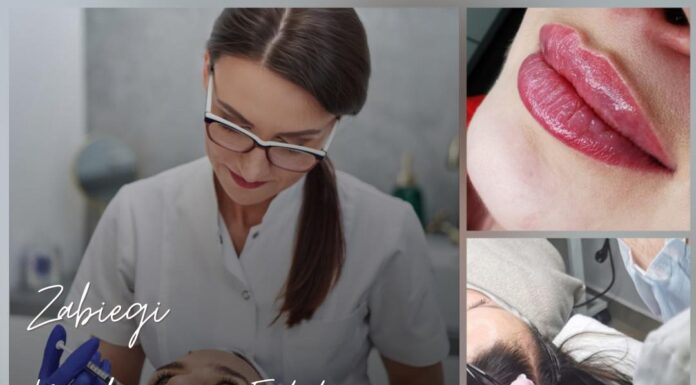 Na czym polega zabieg z wykorzystaniem Dermapenu?